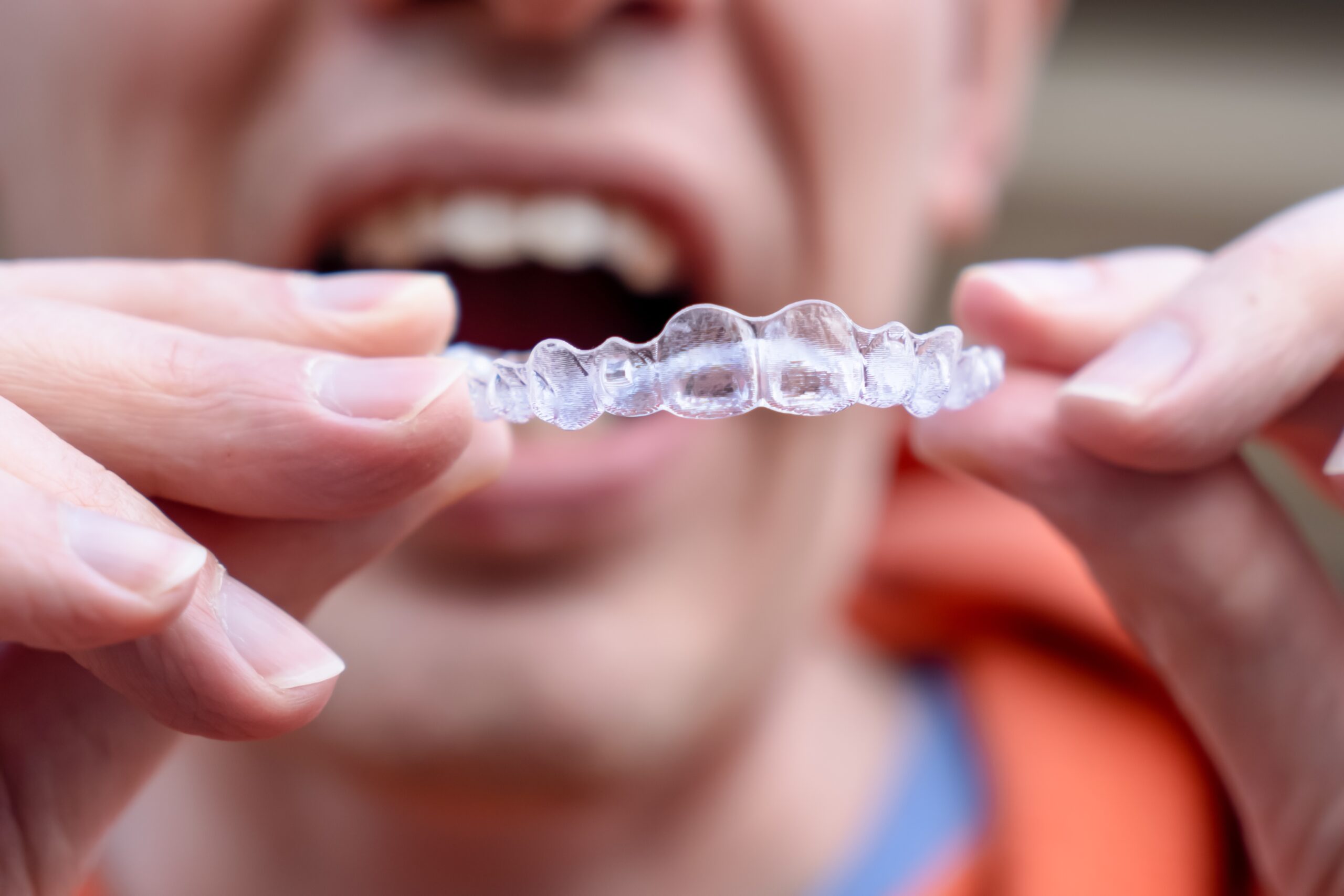 Is Invisalign Right for You? A Complete Guide for Fitchburg Residents