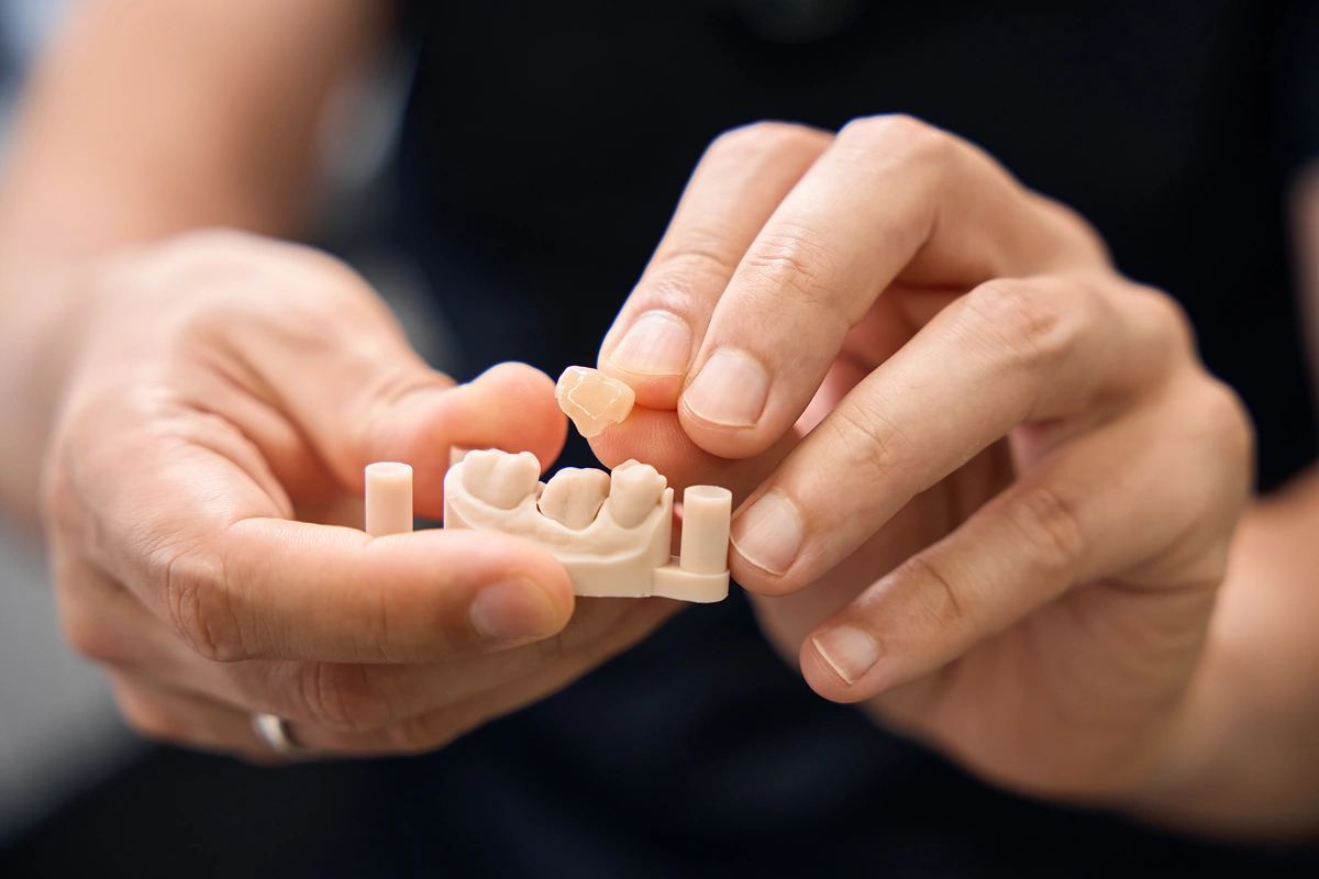 Does Getting a Dental Crown Hurt? Here’s What to Really Expect