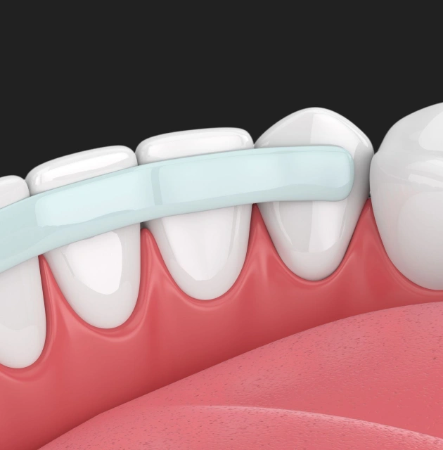 Toothbrush cleaning white teeth and pink gums in a dental care illustration.