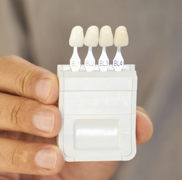Porcelain veneer shade guide showing four tooth-colored samples labeled BL1 through BL4.
