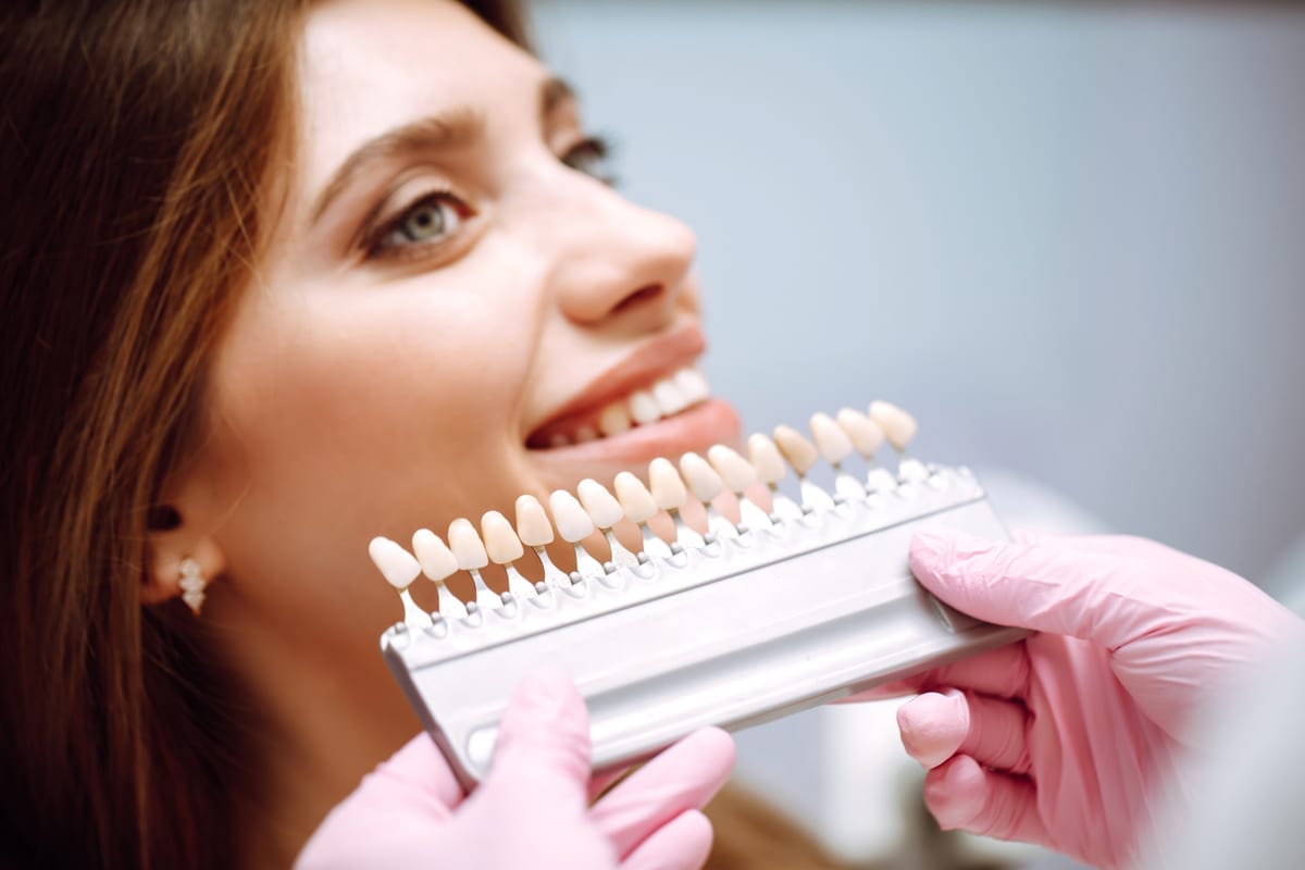 Porcelain vs. Composite Veneers: Which Lasts Longer and Costs Less